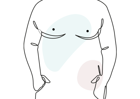 Male Breast Surgery - Dr Mark Kohout