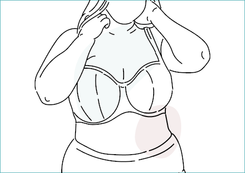 Breast Reduction Gallery Featured Image 2 - Dr Mark Kohout