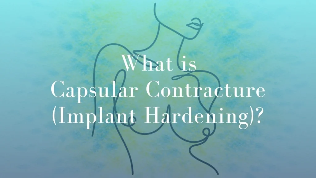 What is Capsular Contracture (Implant Hardening) - Dr Mark Kohout