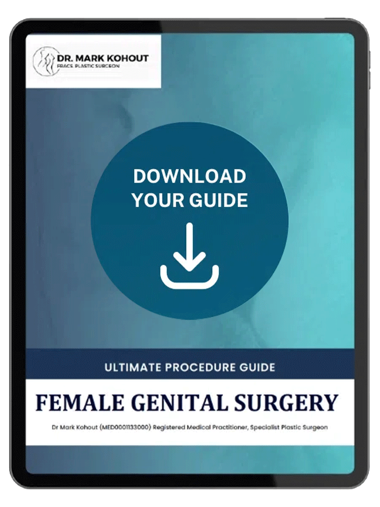 Female Genital Procedure Guide Card