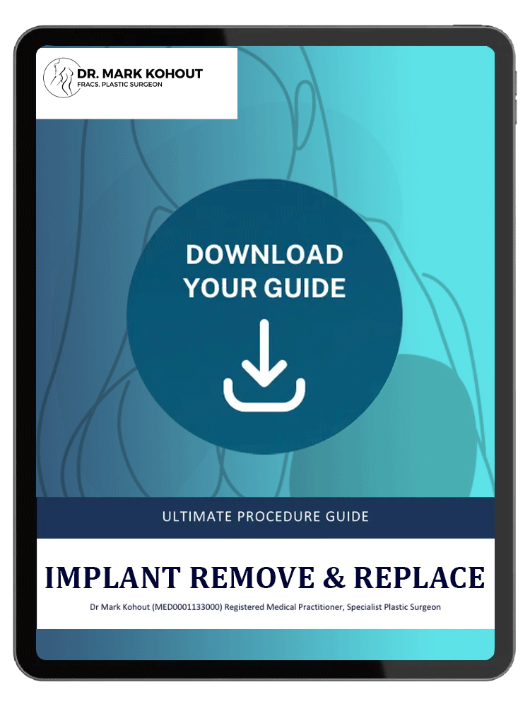 Implant Removal Procedure Guide Card - Exercise After Breast Removal