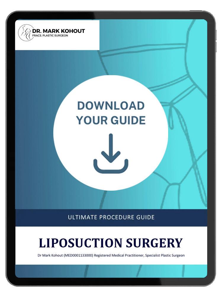 liposuction white - Dr Mark Kohout